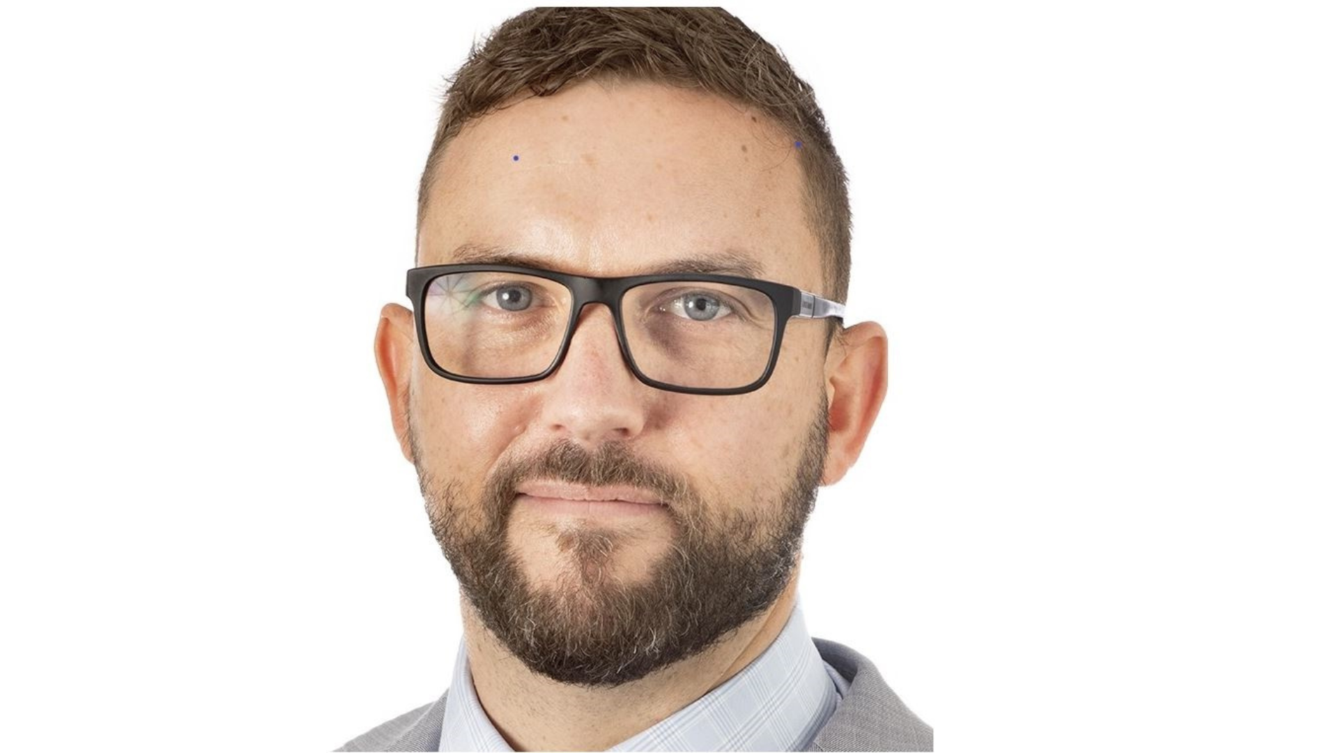 Dermatologist Aaron Robinson on Skin Cancer: Know your ABCDE signs